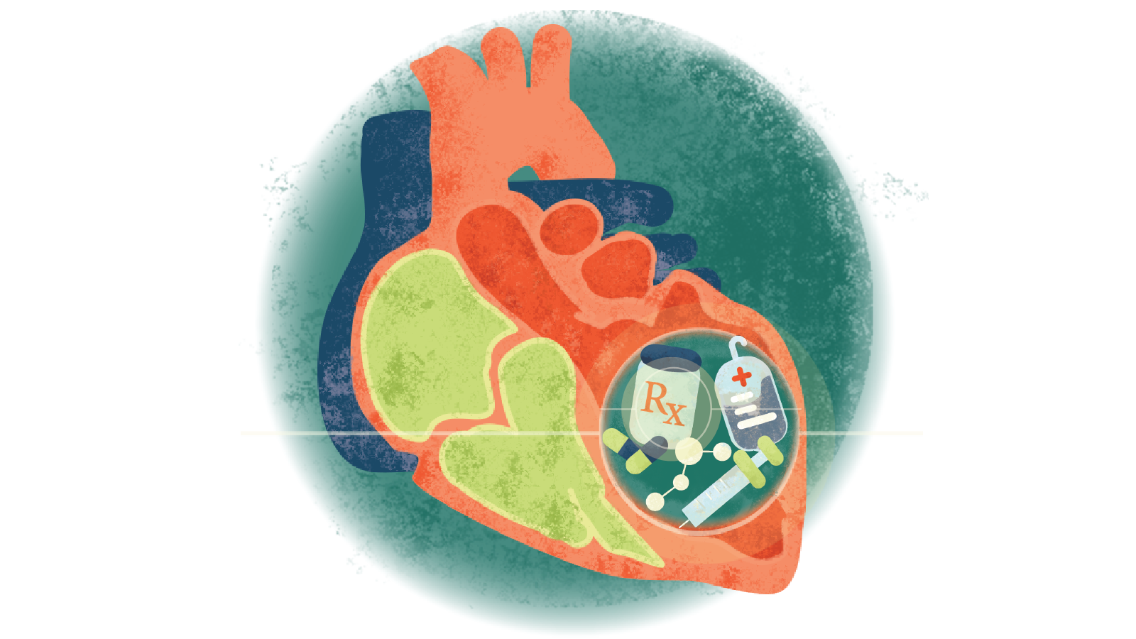Illustration of a line & a circle containing syringe, IV bag & medication bottle with pills over a heart with cardiomyopathy