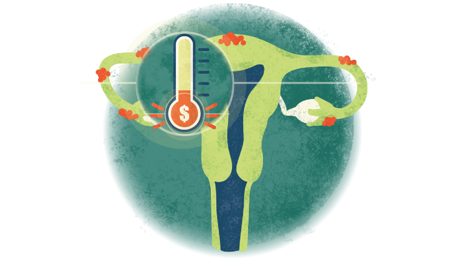 Illustration of a thermometer-looking icon measuring money over a uterus with endometriosis